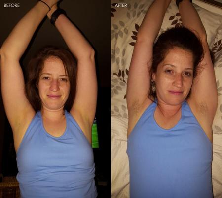 Hairy Armpits - BEFORE AND AFTER