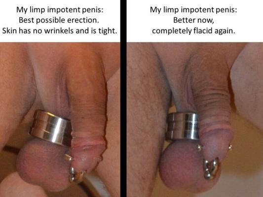 My limp, impotent penis