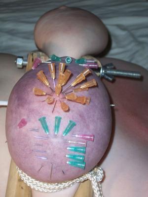 many needles in nipple