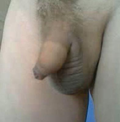 mon clitoris ridiculement petit