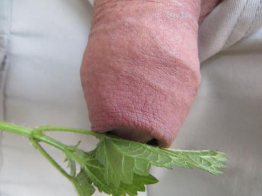 swollen from the nettles