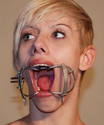 Mouth clamps