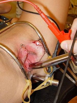 EXTREME torture cunt sewn open clamped clit and pins throughout